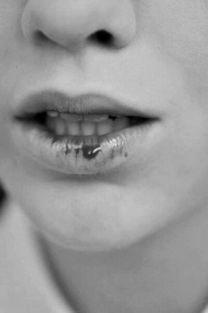 嘴唇流血图片,探寻嘴唇出血背后的秘密